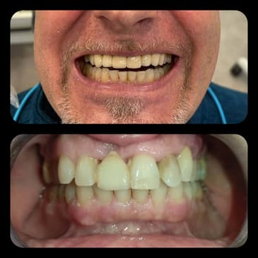 Slider image (3) Dr. Aleksandar Kovacevic - Dental Clinic in Croatia